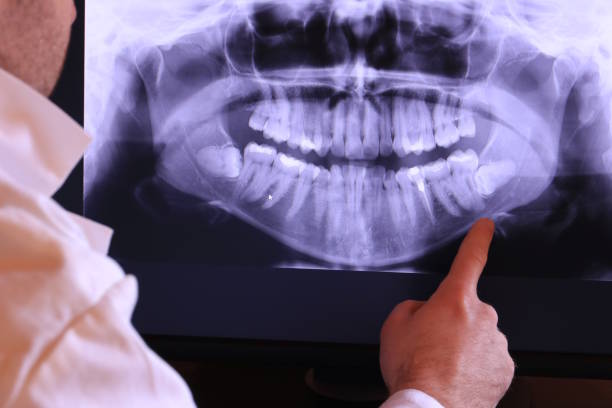 Best Pediatric Emergency Dentist in Lake Mohegan, NY